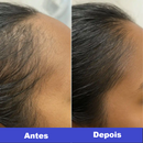 Escova LiviêLed | Saúde para seus Cabelos