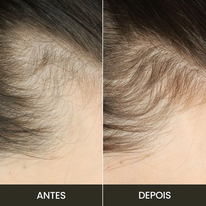 Escova LiviêLed | Saúde para seus Cabelos